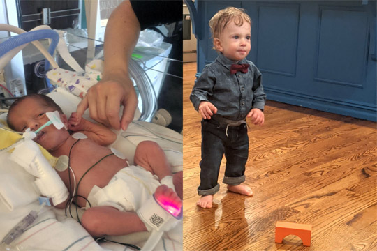 Nico in the NICU and now at 16 months old!